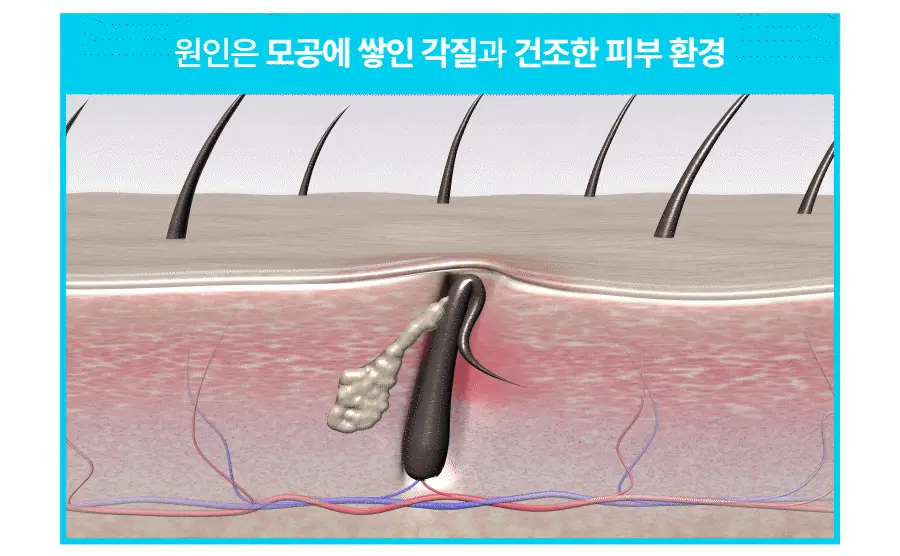 [올영단독] 씨퓨리 바디미스트 200ml 리필 기획세트(+100ml 리필팩) 상세페이지 11